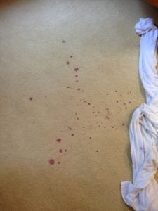 carpet cleaning 1 225x300 - Projects